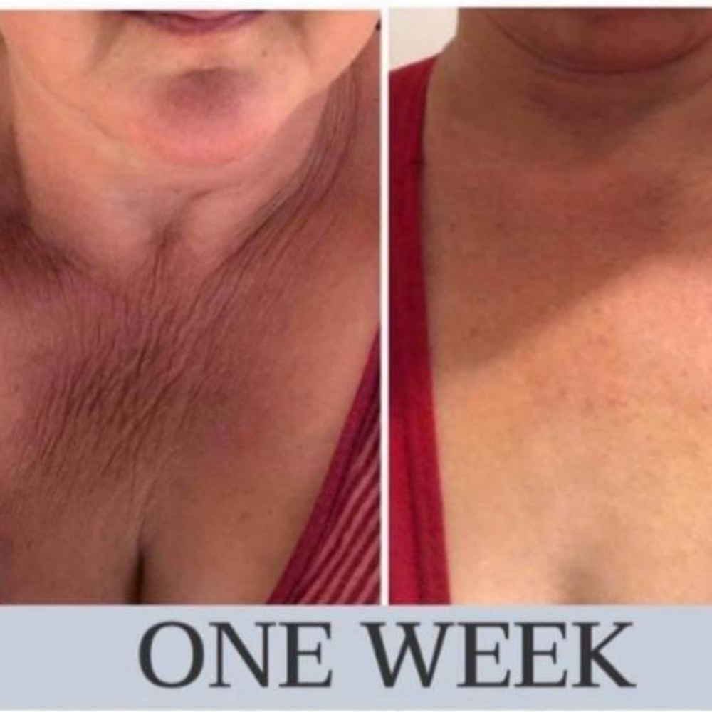 Hibiscus Firming Cream